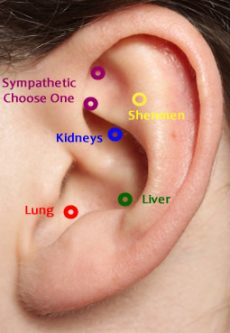 NADA Protocol for Auricular Acupuncture - Philadelphia Addiction Center